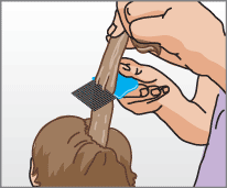 How to comb out head lice 